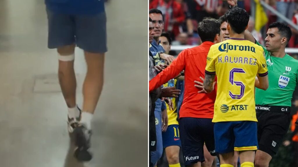 Kevin Álvarez sufre corte en la pierna tras el Chivas 0-0 América
